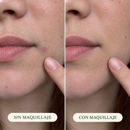 Ghostspot Ultra-Invisible Anti-Pimple Patch