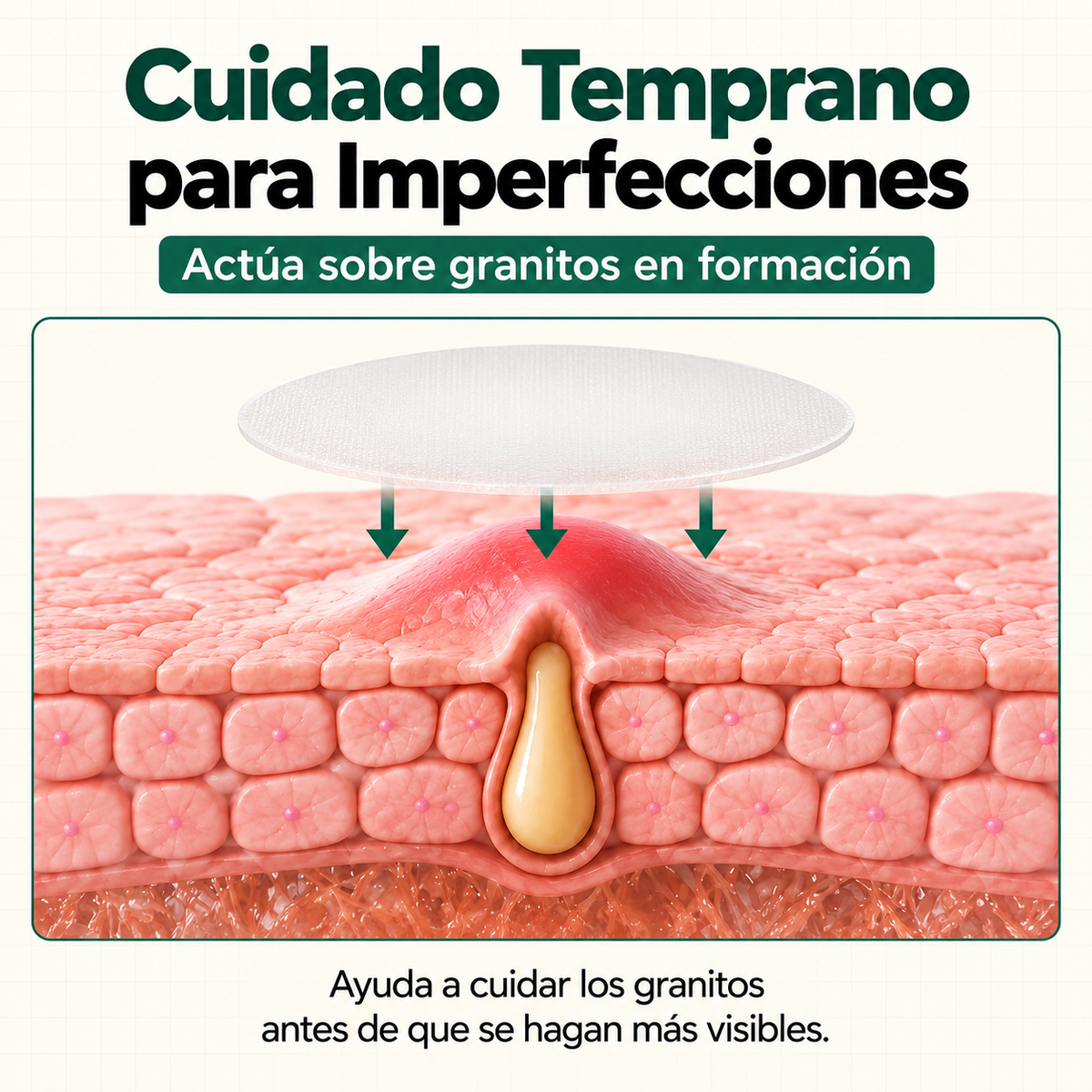 Ghostspot Ultra-Invisible Anti-Pimple Patch