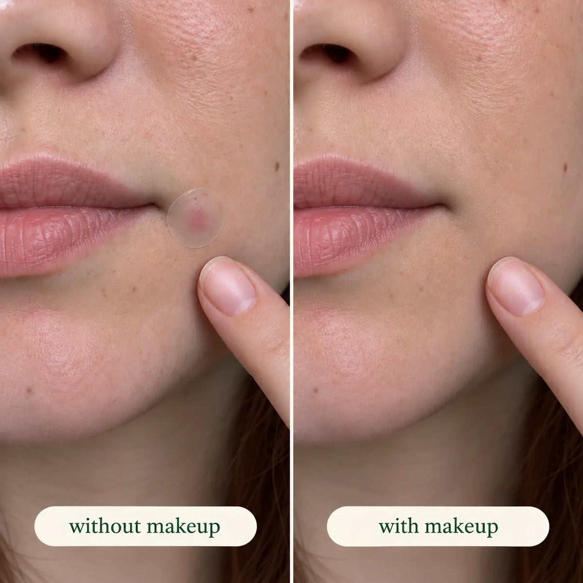 Ghostspot® Ultra-Thin Blemish Patches
