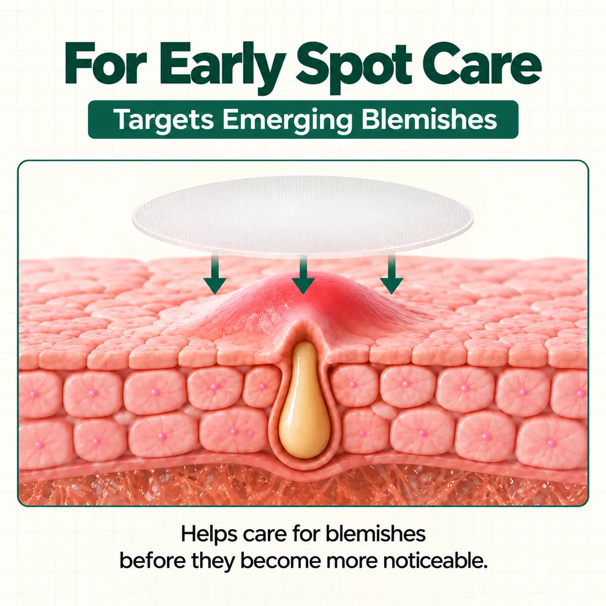 Ghostspot® Ultra-Thin Blemish Patches