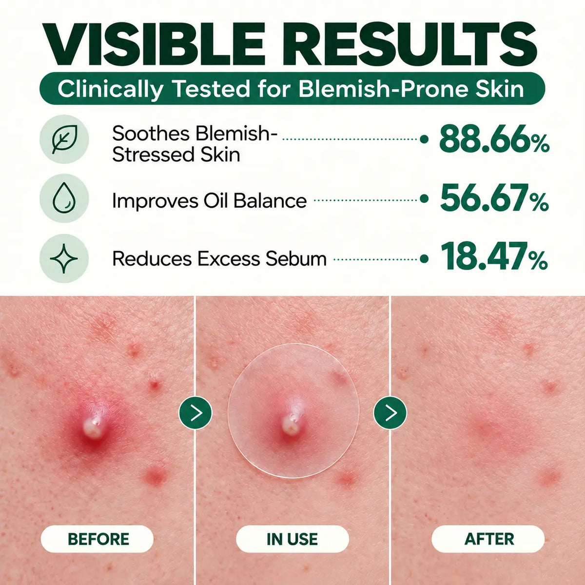 Ghostspot® Ultra-Thin Blemish Patches