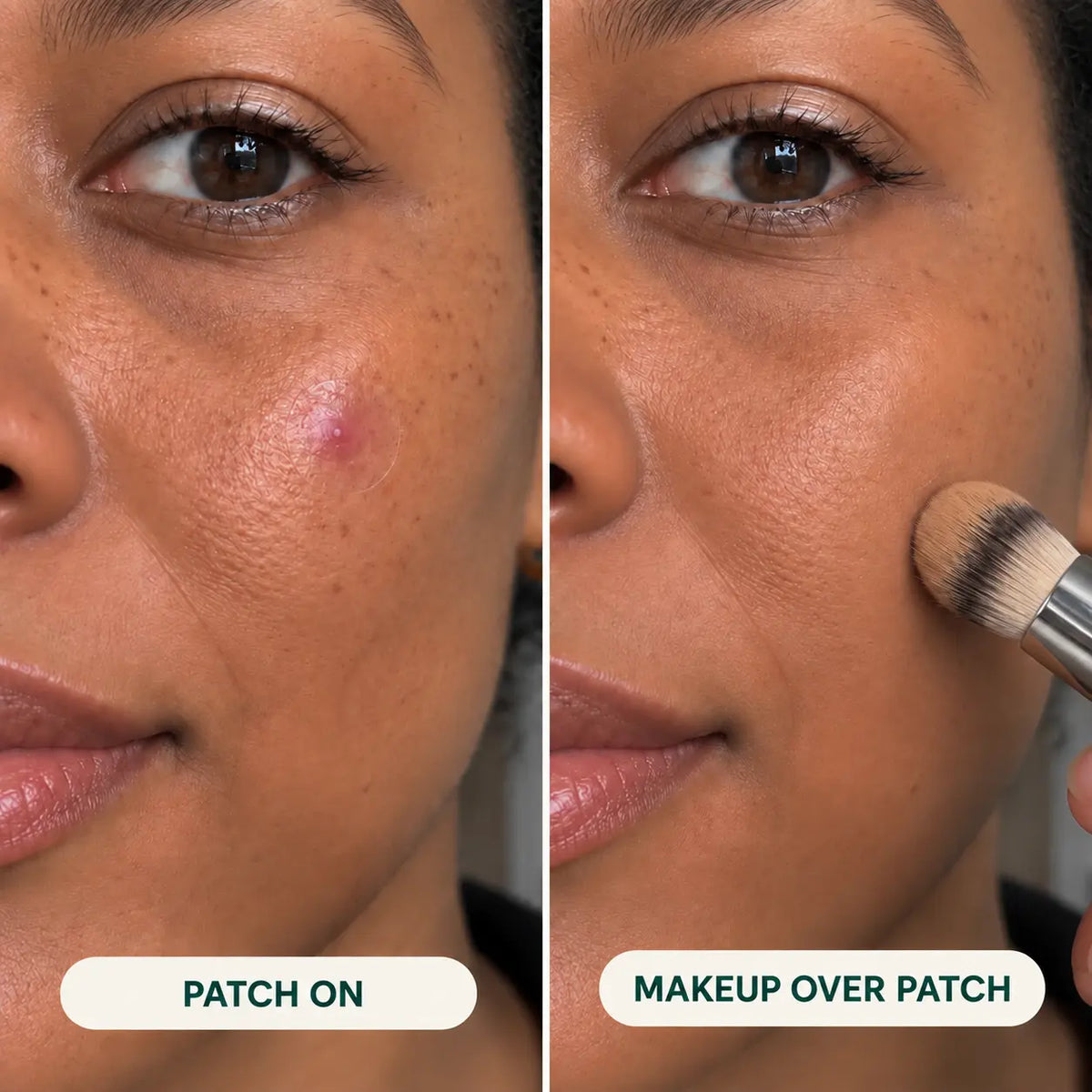 Ghostspot® Ultra-Thin Blemish Patches